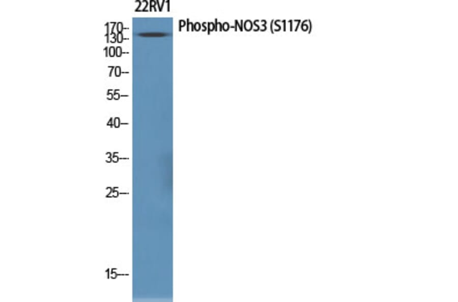 Western Blot - Anti-eNOS (phospho Ser1176) Antibody (A7071) - Antibodies.com
