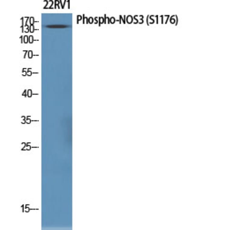 Western Blot - Anti-eNOS (phospho Ser1176) Antibody (A7071) - Antibodies.com