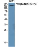 Western Blot - Anti-eNOS (phospho Ser1176) Antibody (A7071) - Antibodies.com