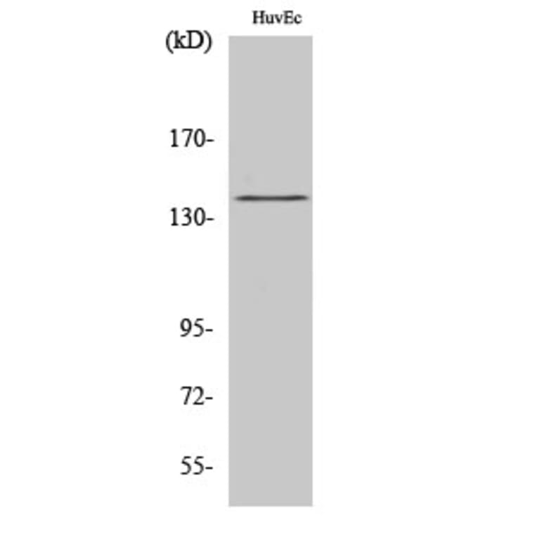Western Blot - Anti-eNOS (phospho Ser1176) Antibody (A7071) - Antibodies.com
