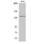 Western Blot - Anti-eNOS (phospho Ser1176) Antibody (A7071) - Antibodies.com