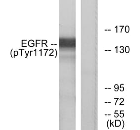 Western Blot - Anti-EGFR (phospho Tyr1172) Antibody (A7063) - Antibodies.com