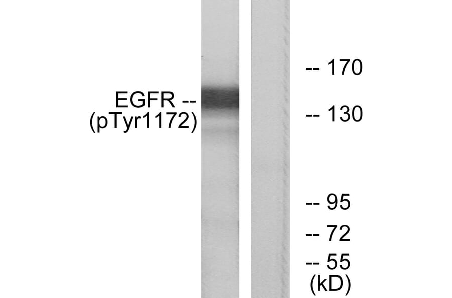 Western Blot - Anti-EGFR (phospho Tyr1172) Antibody (A7063) - Antibodies.com