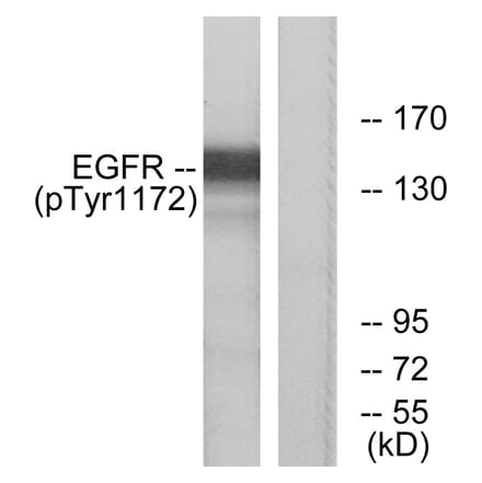 Western Blot - Anti-EGFR (phospho Tyr1172) Antibody (A7063) - Antibodies.com