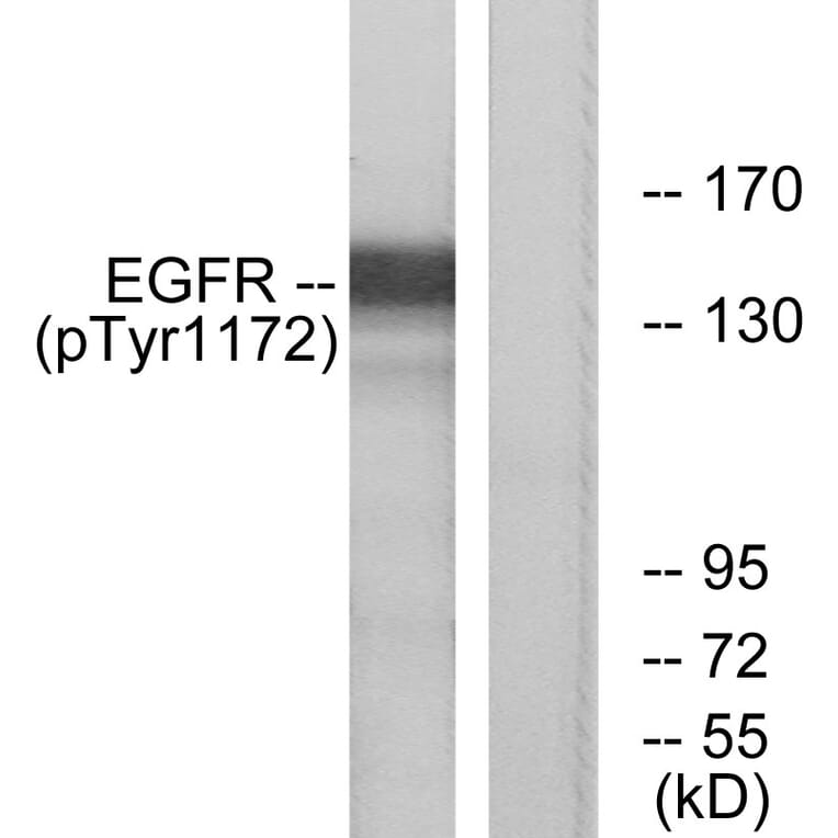 Western Blot - Anti-EGFR (phospho Tyr1172) Antibody (A7063) - Antibodies.com