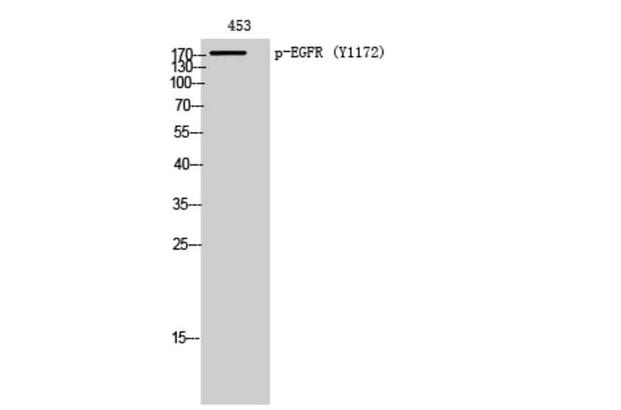 Western Blot - Anti-EGFR (phospho Tyr1172) Antibody (A7063) - Antibodies.com