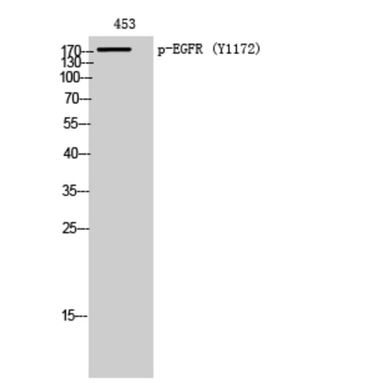 Western Blot - Anti-EGFR (phospho Tyr1172) Antibody (A7063) - Antibodies.com