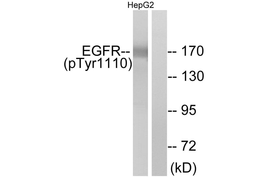 Western Blot - Anti-EGFR (phospho Tyr1110) Antibody (A7062) - Antibodies.com