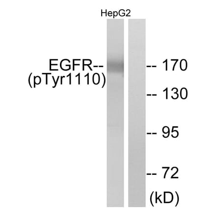 Western Blot - Anti-EGFR (phospho Tyr1110) Antibody (A7062) - Antibodies.com