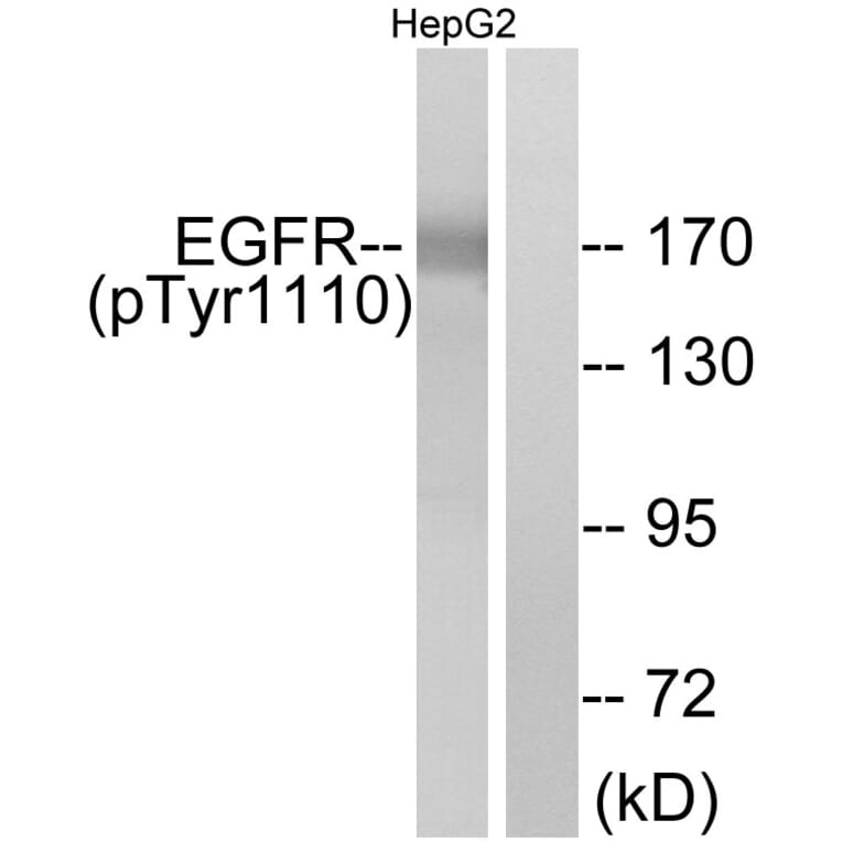 Western Blot - Anti-EGFR (phospho Tyr1110) Antibody (A7062) - Antibodies.com