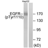 Western Blot - Anti-EGFR (phospho Tyr1110) Antibody (A7062) - Antibodies.com