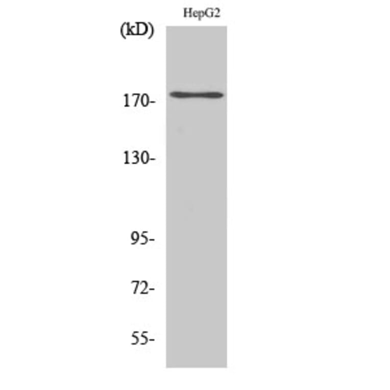 Western Blot - Anti-EGFR (phospho Tyr1110) Antibody (A7062) - Antibodies.com