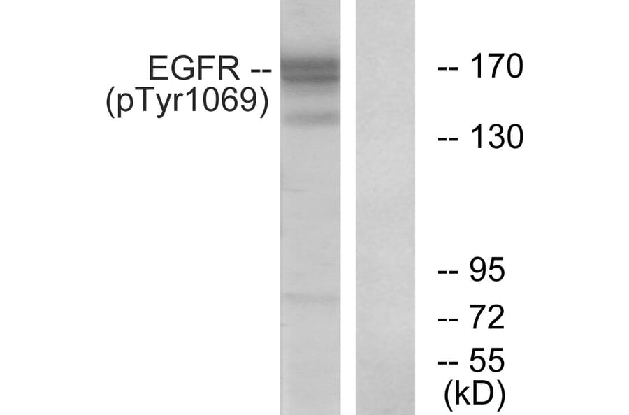 Western Blot - Anti-EGFR (phospho Tyr1069) Antibody (A0912) - Antibodies.com