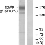 Western Blot - Anti-EGFR (phospho Tyr1069) Antibody (A0912) - Antibodies.com