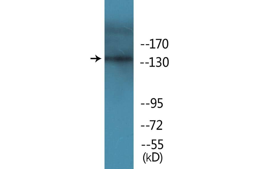 Western Blot - Anti-EGFR (phospho Tyr1069) Antibody (P12-1098) - Antibodies.com