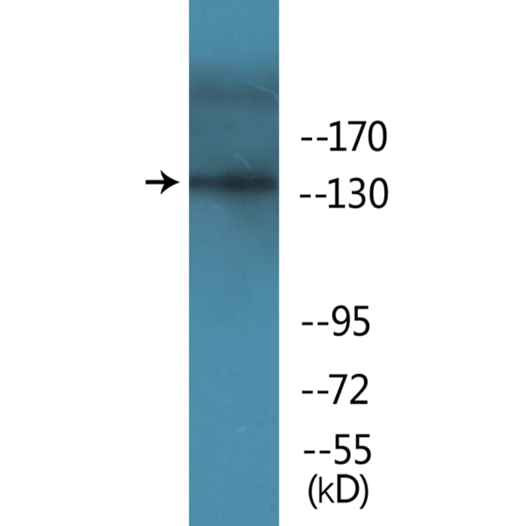 Western Blot - Anti-EGFR (phospho Tyr1069) Antibody (P12-1098) - Antibodies.com
