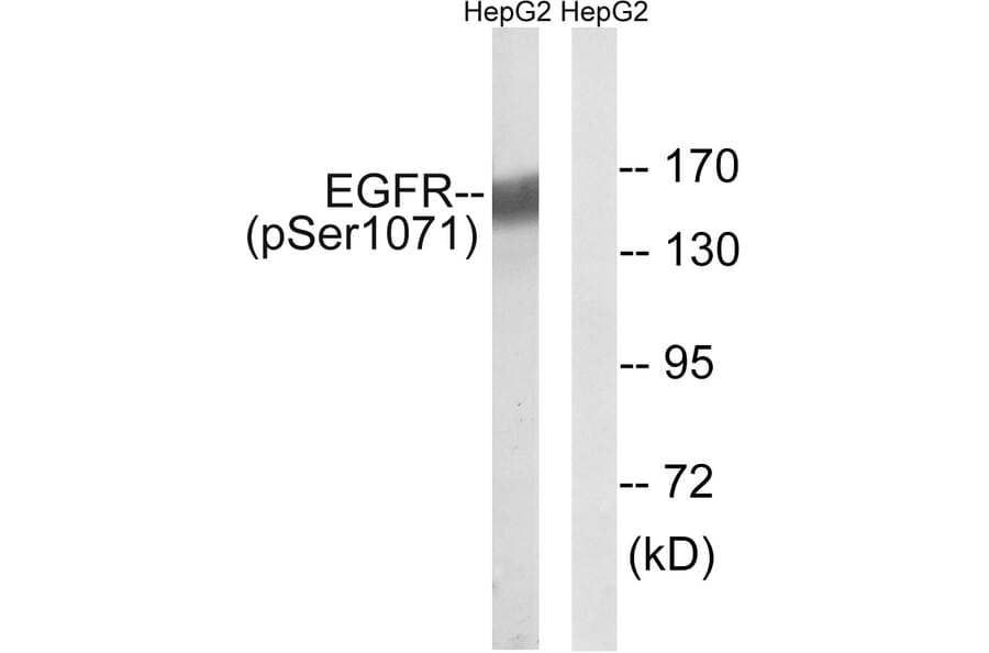 Western Blot - Anti-EGFR (phospho Ser1071) Antibody (A8025) - Antibodies.com
