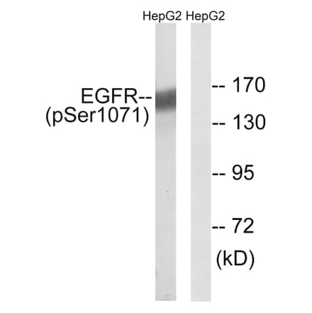 Western Blot - Anti-EGFR (phospho Ser1071) Antibody (A8025) - Antibodies.com