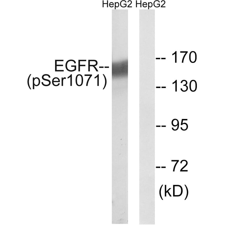 Western Blot - Anti-EGFR (phospho Ser1071) Antibody (A8025) - Antibodies.com
