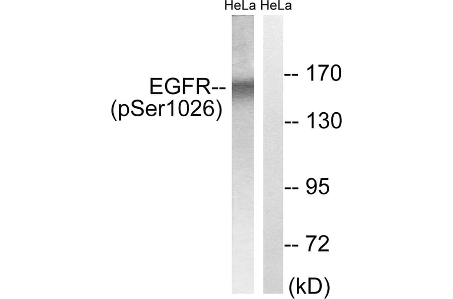Western Blot - Anti-EGFR (phospho Ser1026) Antibody (A8024) - Antibodies.com