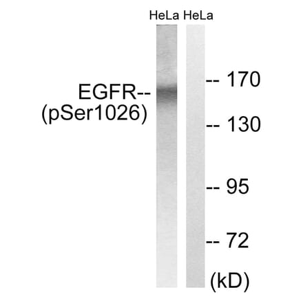 Western Blot - Anti-EGFR (phospho Ser1026) Antibody (A8024) - Antibodies.com