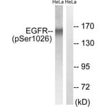 Western Blot - Anti-EGFR (phospho Ser1026) Antibody (A8024) - Antibodies.com