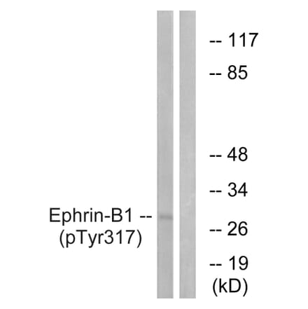 Western Blot - Anti-EFNB1 (phospho Tyr317) Antibody (A0916) - Antibodies.com