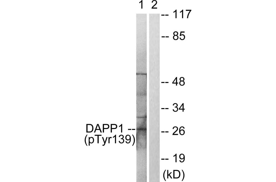 Western Blot - Anti-DAPP1 (phospho Tyr139) Antibody (A0901) - Antibodies.com