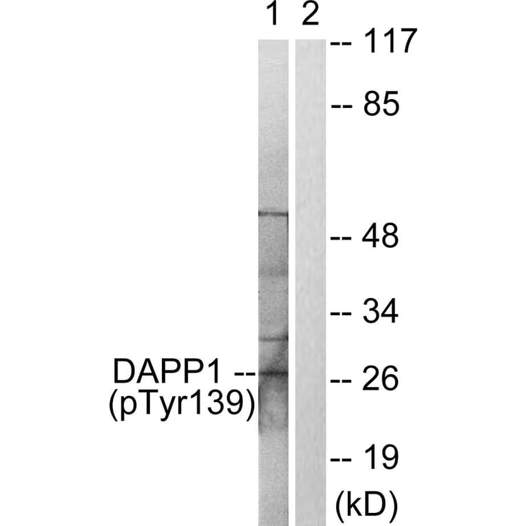 Western Blot - Anti-DAPP1 (phospho Tyr139) Antibody (A0901) - Antibodies.com