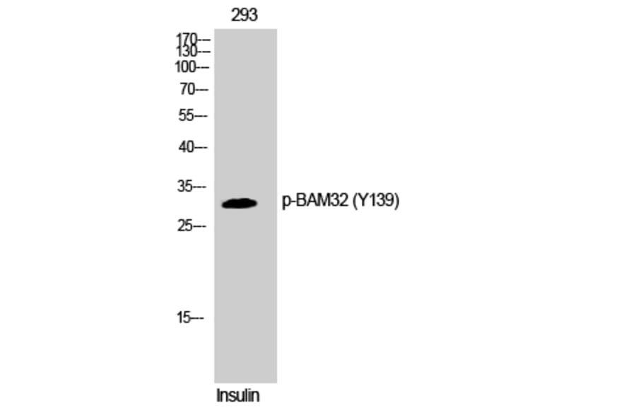 Western Blot - Anti-DAPP1 (phospho Tyr139) Antibody (A0901) - Antibodies.com