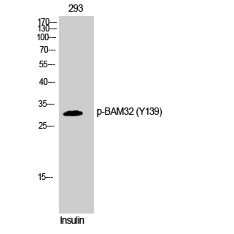 Western Blot - Anti-DAPP1 (phospho Tyr139) Antibody (A0901) - Antibodies.com