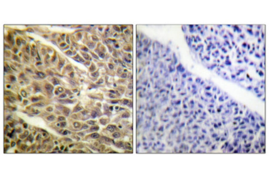 Immunohistochemistry - Anti-DAPK1 (phospho Ser308) Antibody (A0898) - Antibodies.com