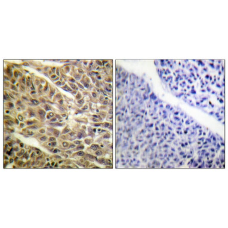 Immunohistochemistry - Anti-DAPK1 (phospho Ser308) Antibody (A0898) - Antibodies.com