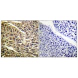 Immunohistochemistry - Anti-DAPK1 (phospho Ser308) Antibody (A0898) - Antibodies.com