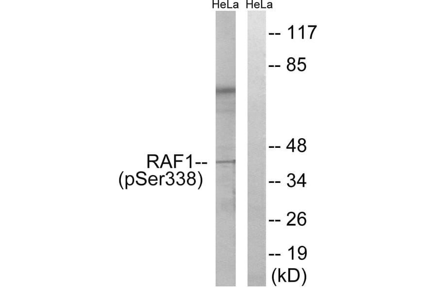 Western Blot - Anti-C-RAF (phospho Ser338) Antibody (A7207) - Antibodies.com