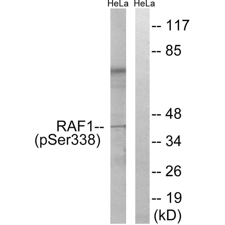 Western Blot - Anti-C-RAF (phospho Ser338) Antibody (A7207) - Antibodies.com