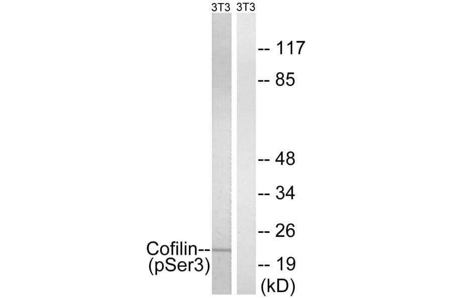 Western Blot - Anti-Cofilin (phospho Ser3) Antibody (A7047) - Antibodies.com