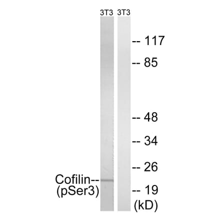 Western Blot - Anti-Cofilin (phospho Ser3) Antibody (A7047) - Antibodies.com