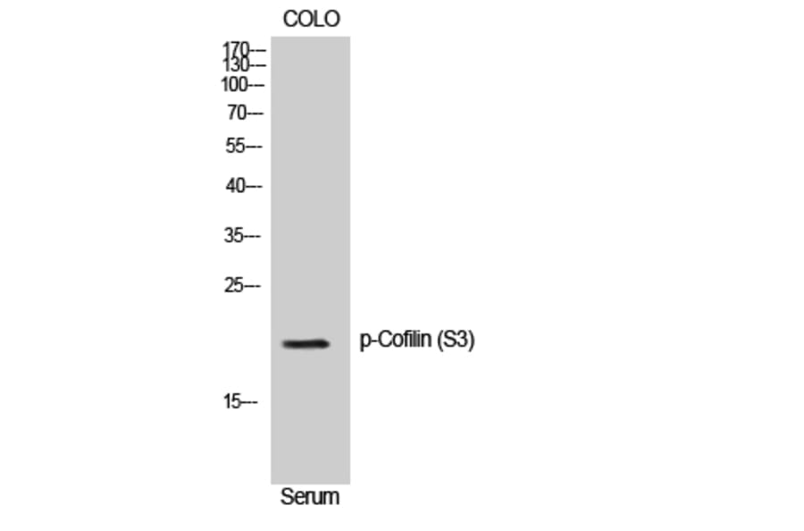 Western Blot - Anti-Cofilin (phospho Ser3) Antibody (A7047) - Antibodies.com