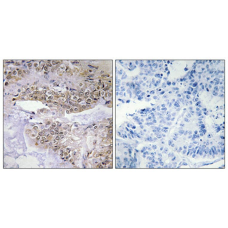Immunohistochemistry - Anti-Cofilin (phospho Ser3) Antibody (A7047) - Antibodies.com