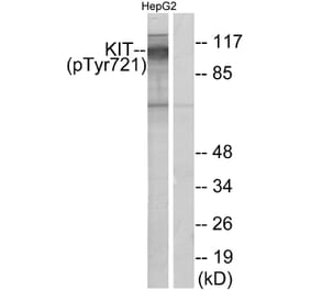 Western Blot - Anti-c-Kit (phospho Tyr721) Antibody (A7138) - Antibodies.com