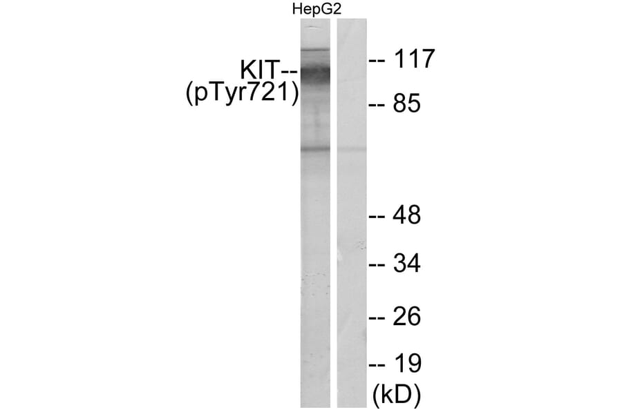 Western Blot - Anti-c-Kit (phospho Tyr721) Antibody (A7138) - Antibodies.com