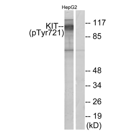 Western Blot - Anti-c-Kit (phospho Tyr721) Antibody (A7138) - Antibodies.com
