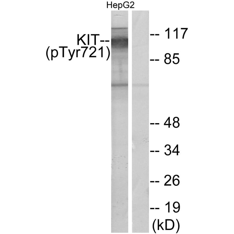 Western Blot - Anti-c-Kit (phospho Tyr721) Antibody (A7138) - Antibodies.com