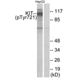 Western Blot - Anti-c-Kit (phospho Tyr721) Antibody (A7138) - Antibodies.com