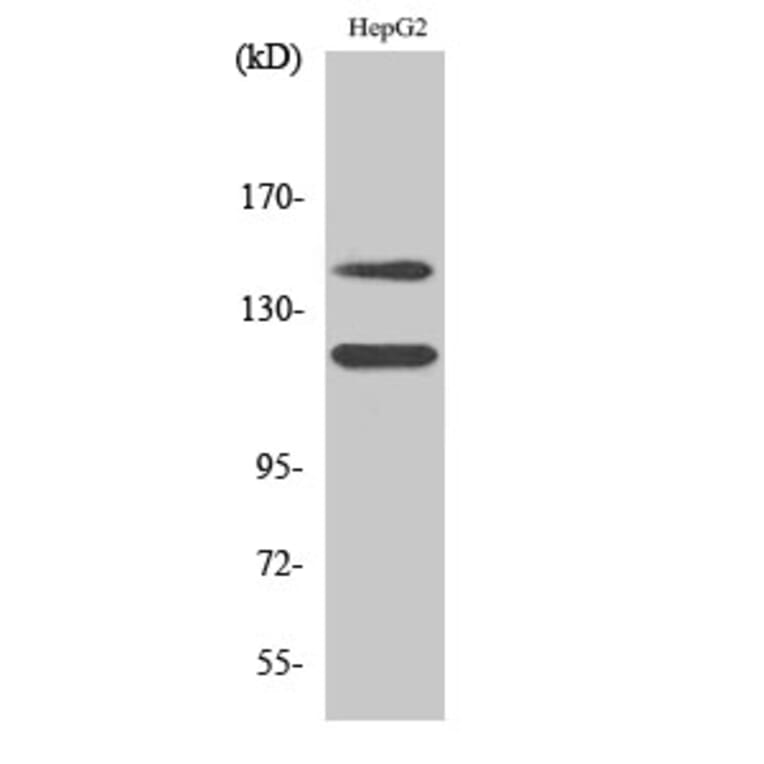 Western Blot - Anti-c-Kit (phospho Tyr721) Antibody (A7138) - Antibodies.com