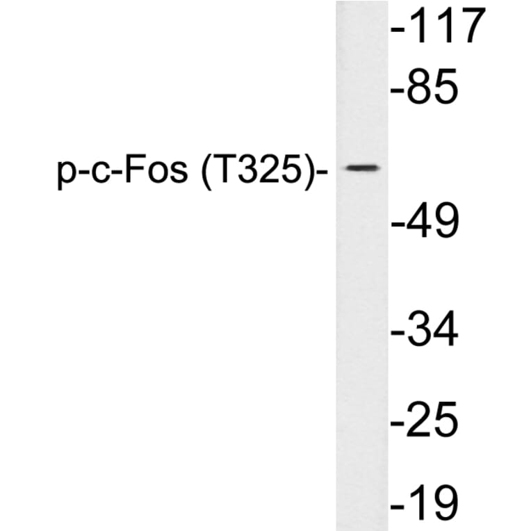 Western Blot - Anti-c-Fos (phospho Thr325) Antibody (P12-1015) - Antibodies.com