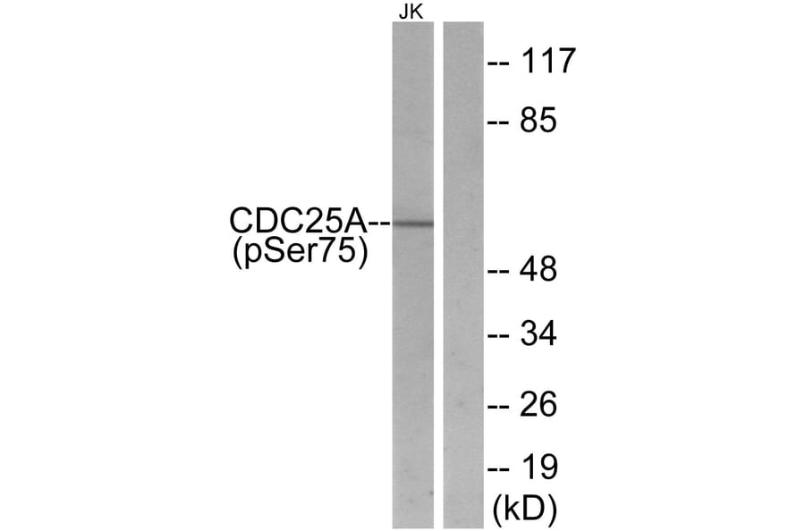 Western Blot - Anti-CDC25A (phospho Ser75) Antibody (A7037) - Antibodies.com