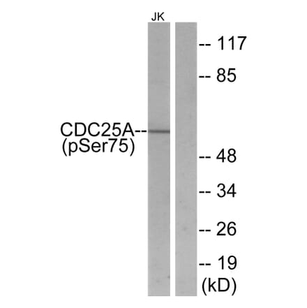 Western Blot - Anti-CDC25A (phospho Ser75) Antibody (A7037) - Antibodies.com