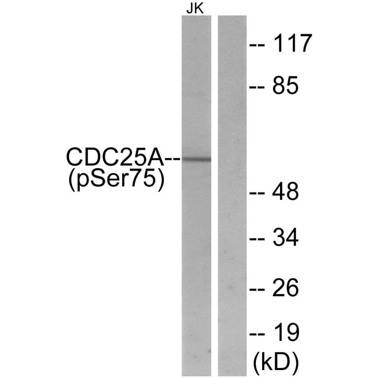 Western Blot - Anti-CDC25A (phospho Ser75) Antibody (A7037) - Antibodies.com